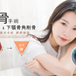 削骨權威郭菁松醫師幫ketty與國字臉做了完整的切割