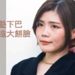 削骨與墊下巴複合式手術成果展示